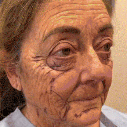 💥BBOJI™ 7-Day Multi-Effect All-in-One Skincare Cream (👨‍⚕️AAD Recommended)