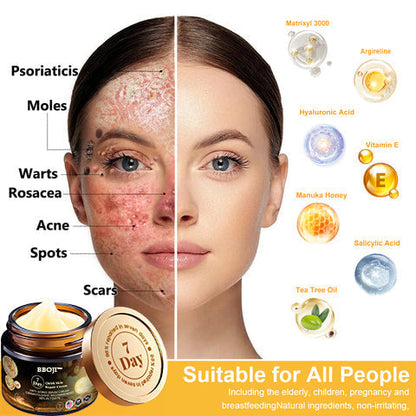 💥BBOJI™ 7-Day Multi-Effect All-in-One Skincare Cream (👨‍⚕️AAD Recommended)