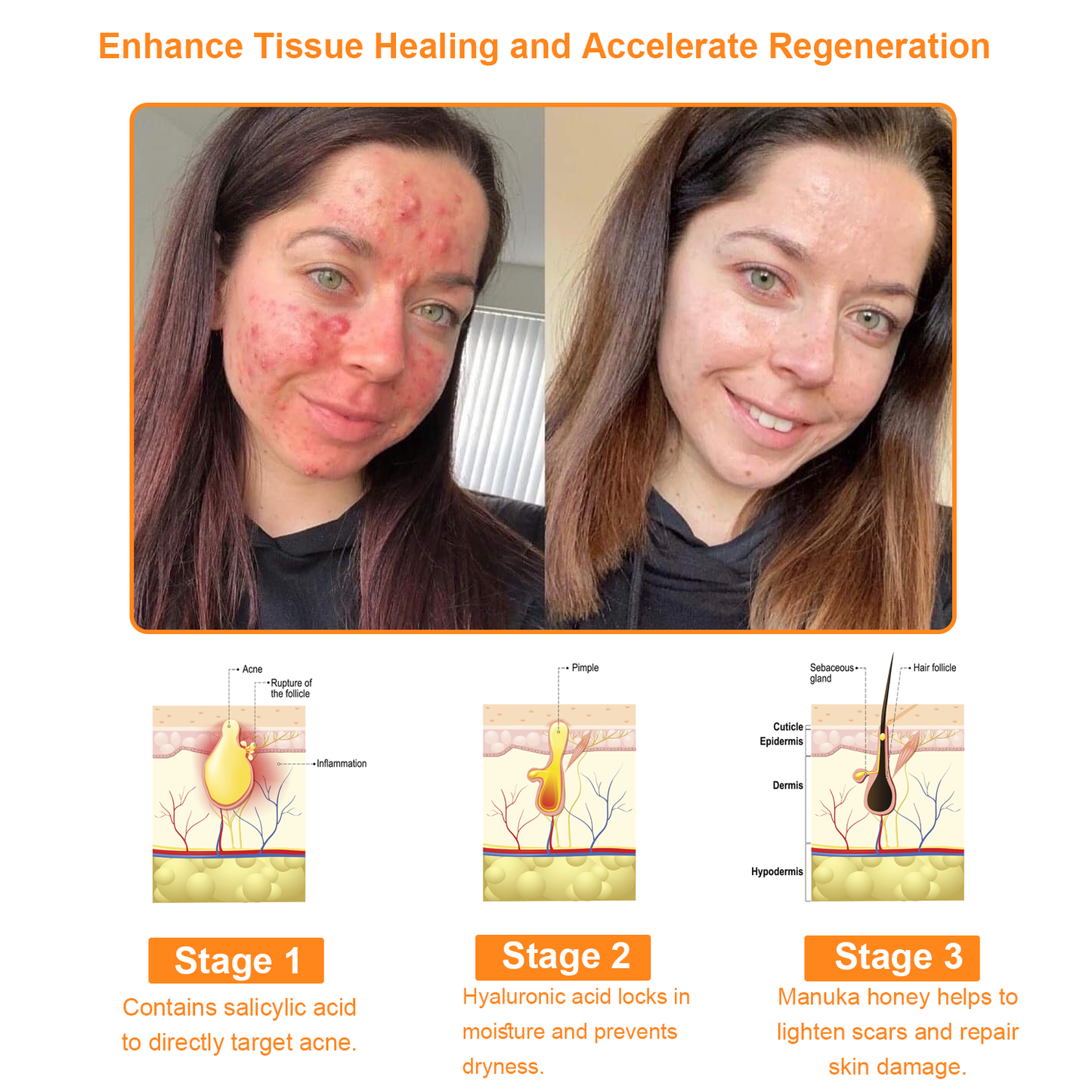 💥BBOJI™ 7-Day Multi-Effect All-in-One Skincare Cream (👨‍⚕️AAD Recommended)