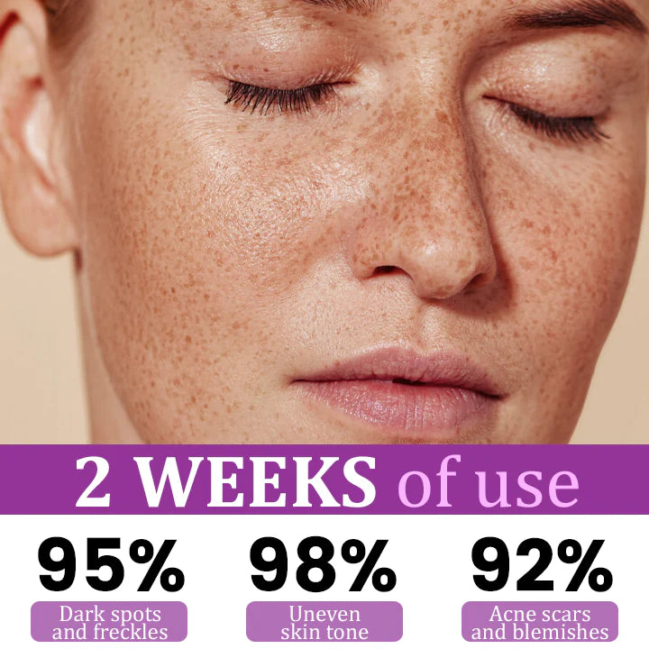 MelantraX Advanced Anti-Hyperpigmentation Essence