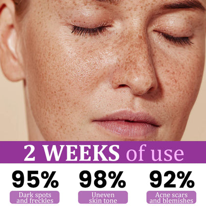 MelantraX Advanced Anti-Hyperpigmentation Essence