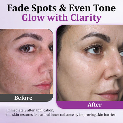 MelantraX Advanced Anti-Hyperpigmentation Essence